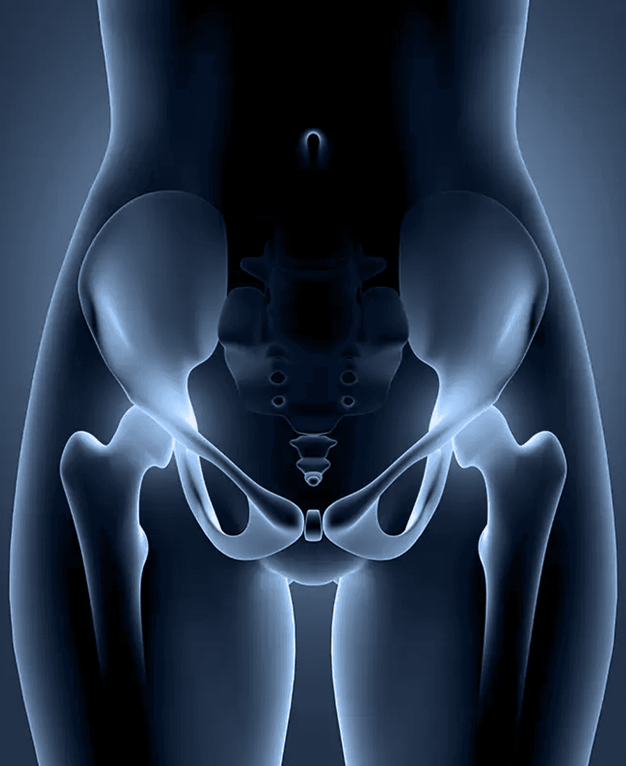 Lesão do Labrum Acetabular ou Lábio